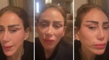 وشي حالته بتسوء.. ريهام سعيد نفنح النار على طبيب التجميل اللبناني