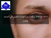 7 نصائح لعلاج ووقاية من التهابات العيون في الصيف والغبار