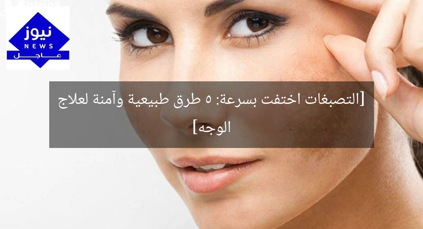 [التصبغات اختفت بسرعة: 5 طرق طبيعية وآمنة لعلاج الوجه]
