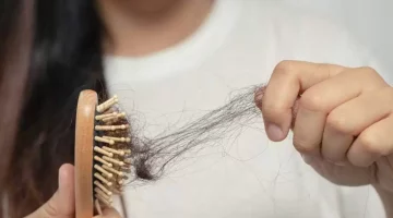 وداعًا للتساقط: علاج طبيعي يعيد شعرك كما كان سريعًا