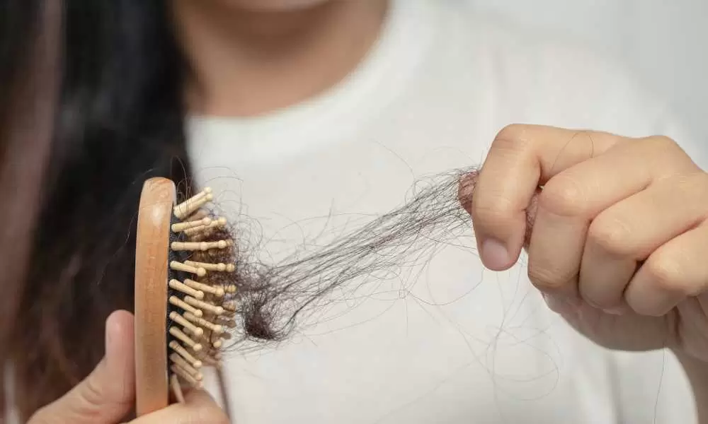 وداعًا للتساقط: علاج طبيعي يعيد شعرك كما كان سريعًا