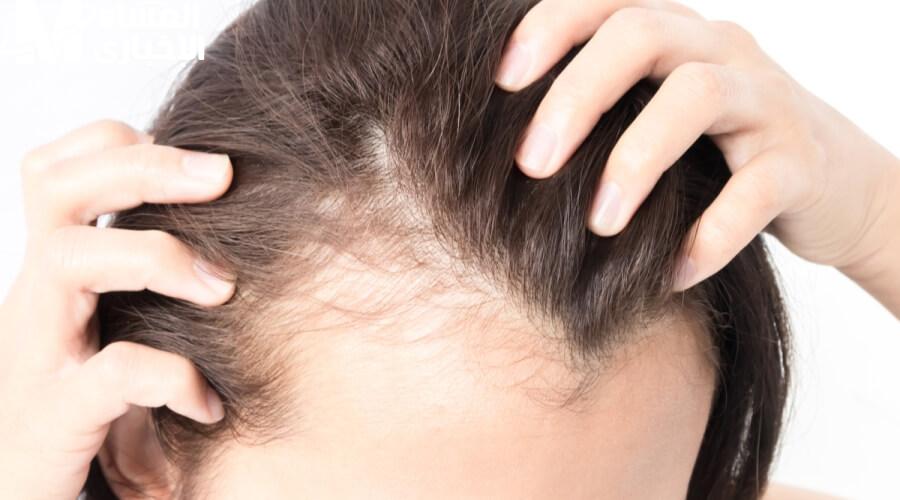 وداعاً للفراغات: 5 طرق سحرية لتكثيف وملء الشعر بالبيت