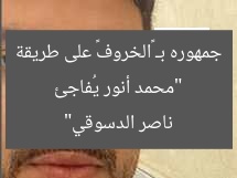 “محمد أنور يُفاجئ جمهوره بـ «الخروف» على طريقة ناصر الدسوقي”