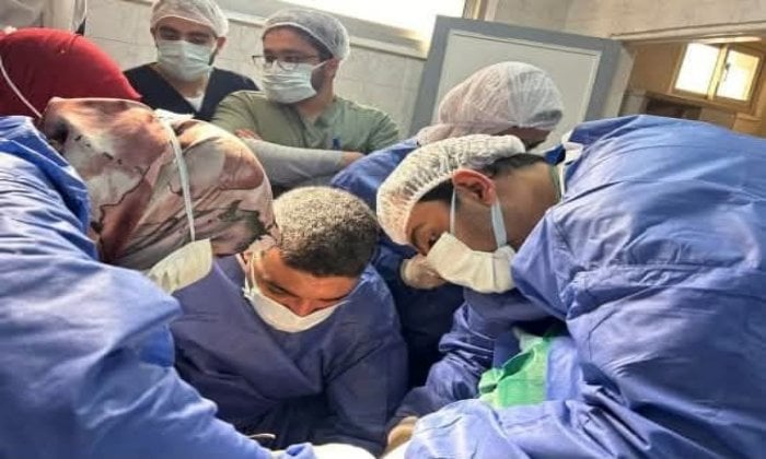 إنقاذ حياة مريض يعاني من غرغرينا بالقولون والأمعاء الدقيقة بمستشفى بنها الجامعي