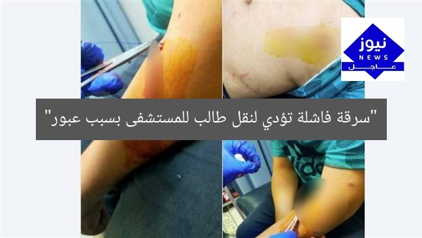 “سرقة فاشلة تؤدي لنقل طالب للمستشفى بسبب عبور”