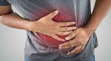 مفاجأة عن علاقة حرقة المعدة بالسرطان.. و7 أعراض لا تتجاهلها