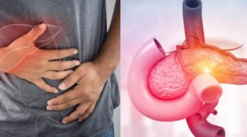 6 علامات مبكرة تكشف إصابتك بسرطان البنكرياس.. لا تتجاهلها
