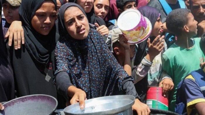 استشهاد 10 فلسطينيين بينهم طفلان بسبب المجاعة وسوء التغذية في غزة