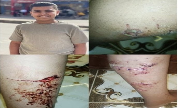 القبض على المتهم بالإعتداء على مصطاف بكلب شرس على شاطئ بورسعيد