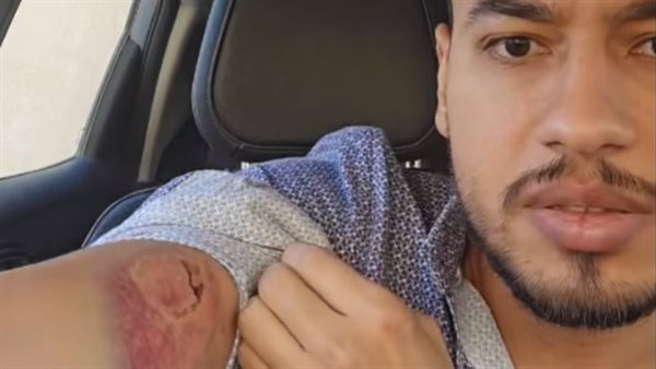 فيديو مشاجرة بين طبيب وطليقته في أكتوبر..«عض وتكسير وضرب»