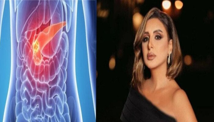 «مفيش خطأ طبي».. محمود سعد يكشف آخر تطورات الحالة الصحية لـ أنغام