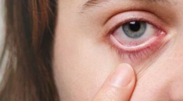 قد يكون عرض على مشكلة أكبر.. ما هي أسباب رفة العين؟