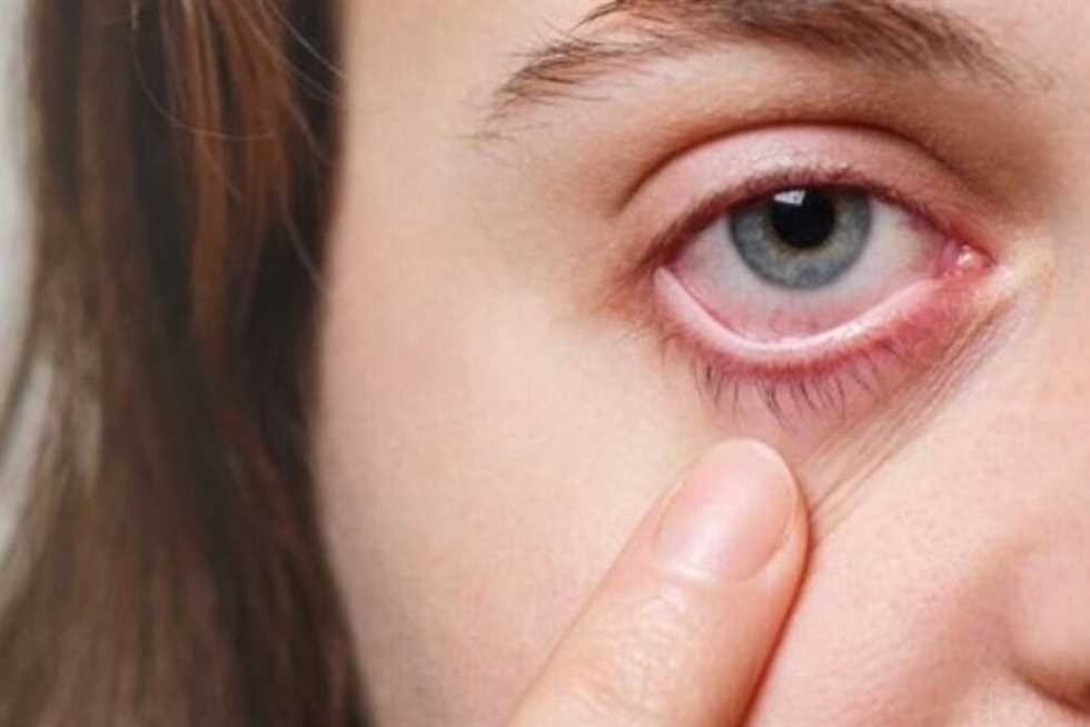 قد يكون عرض على مشكلة أكبر.. ما هي أسباب رفة العين؟