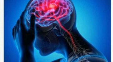 لتفادي إعاقة دائمة.. طرق فعالة للوقاية من السكتة الدماغية