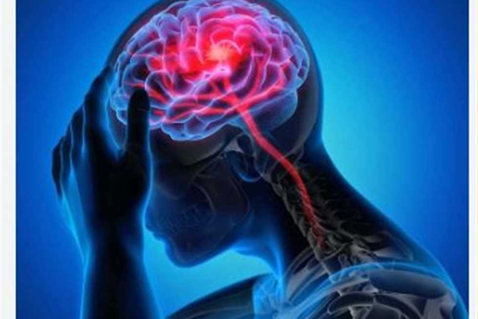 لتفادي إعاقة دائمة.. طرق فعالة للوقاية من السكتة الدماغية