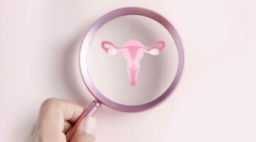 منها مشروبات الطاقة.. أطعمة ومشروبات ممنوعة لمرضى تكيسات المبايض
