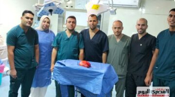 نجاح استئصال ورم ضخم زنة 5 كجم بمستشفى كفر الشيخ العام