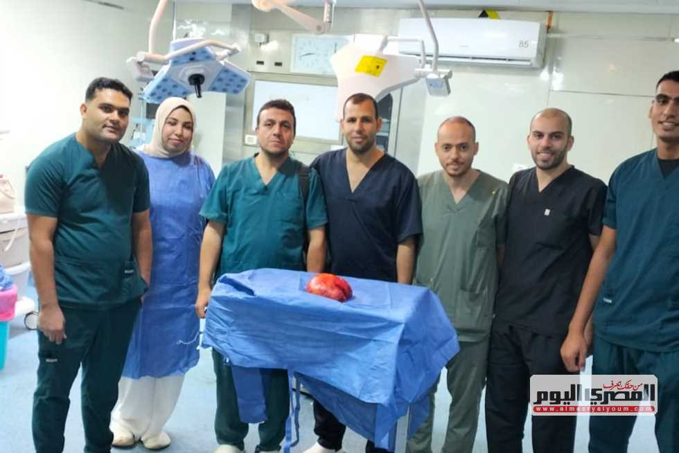 نجاح استئصال ورم ضخم زنة 5 كجم بمستشفى كفر الشيخ العام