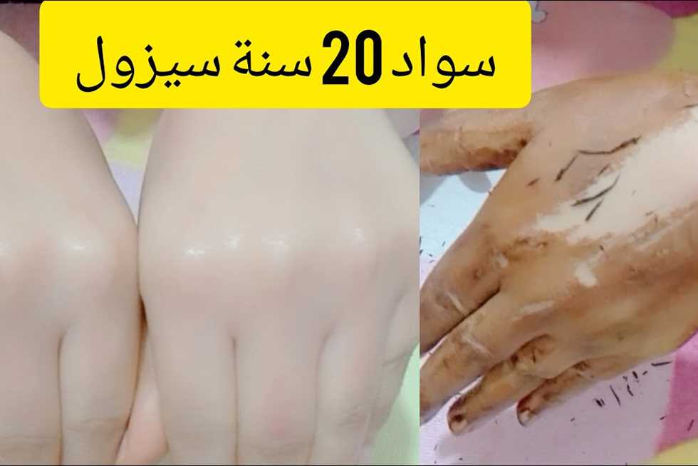 «هتقضي على سواد السنين».. خلطات تفتيح للبشرة طبيعية بالكركم والبرتقال