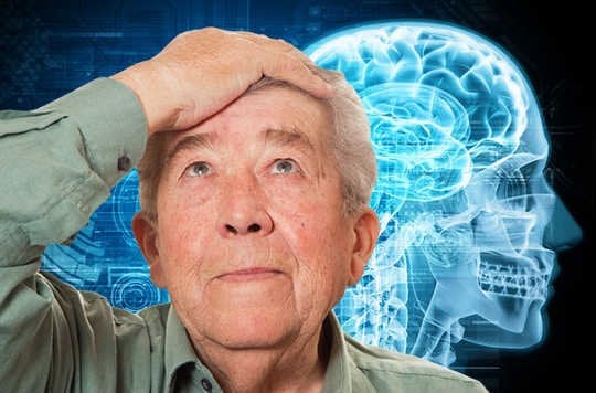 تسرّع شيخوخة الدماغ.. دراسة جديدة تحذر من «قلة النوم»
