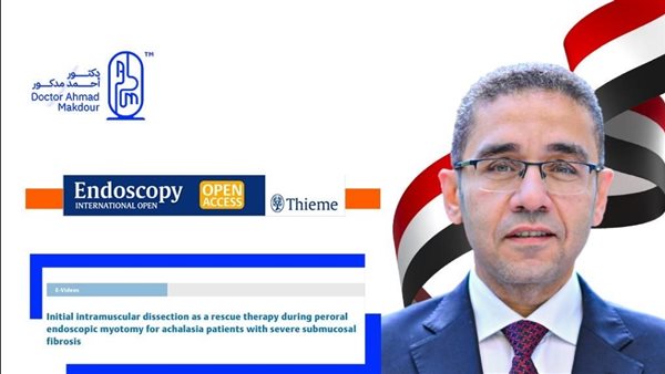 جامعة حلوان تهنئ الدكتور أحمد مدكور بعد اعتماد تقنية "مدكور" عالميًا في مجال مناظير الجهاز الهضمي