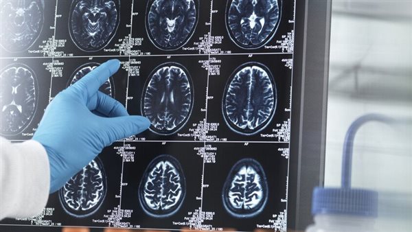 حركة غير متوقعة تحدث "صدمة" إيجابية للدماغ وتقوي الذاكرة