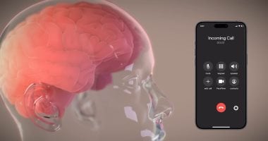 شريحة إيلون ماسك تستعد لترجمة الأفكار إلى نصوص فى الدماغ