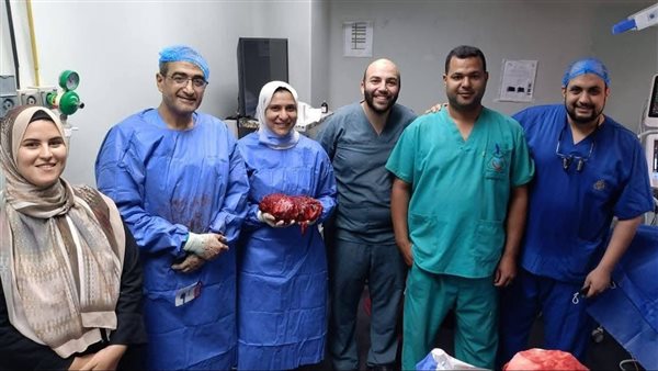 نجاح فريق طبي بمستشفيات جامعة المنوفية في استئصال ورم يزن 4 كيلو جرام بالتجويف الصدري