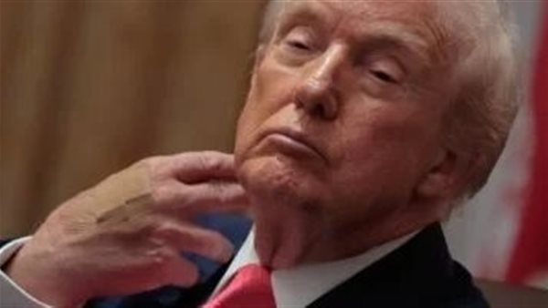 عاجل.. ترامب يظهر بضمادة على معصمه أثناء توقيع اتفاقية سلام فى أفريقيا.. اعرف التفاصيل