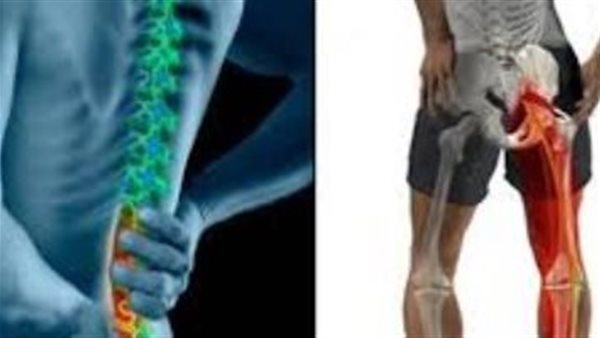 عاجل.. طبيب يوضح أفضل طريقة لاكتشاف عرق النسا .. اختبارات تكشف مصدر الألم بوضوح