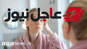 هل يمكن لتحليل صورة الوجه تحديد شدة المرض بدقة وفقًا لدراسات طبية جديدة